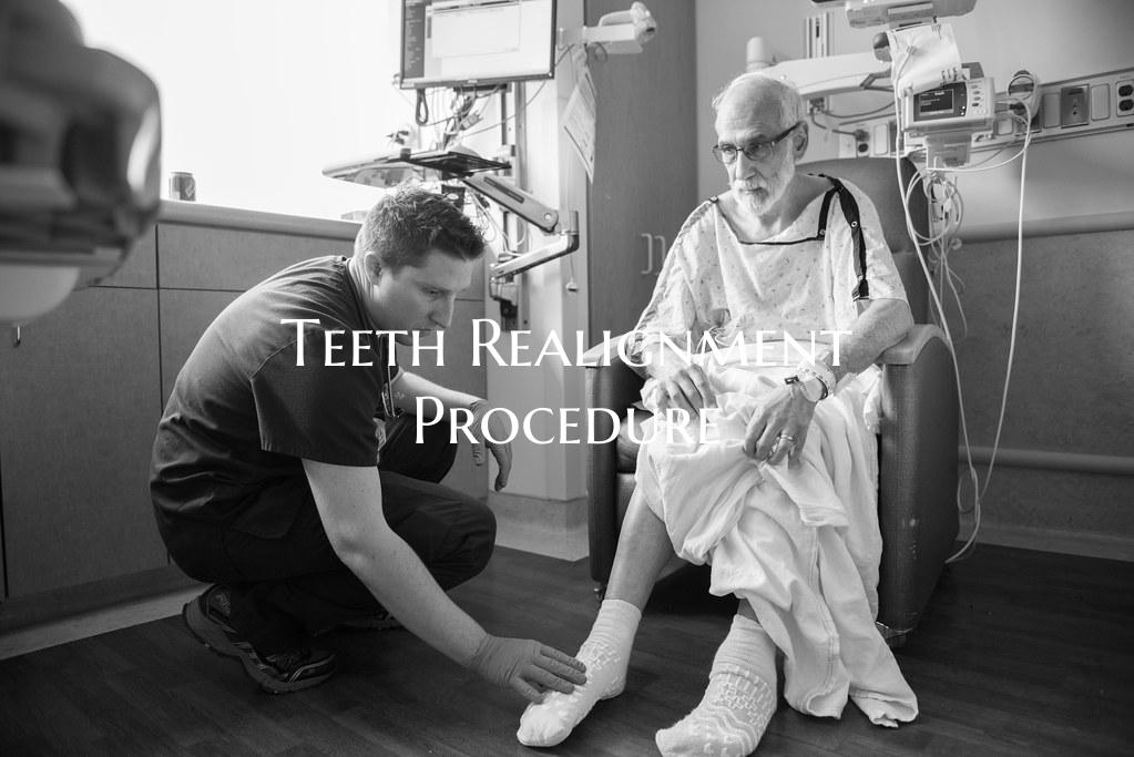 Teeth Realignment Procedure