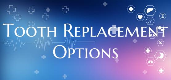 Tooth Replacement Options
