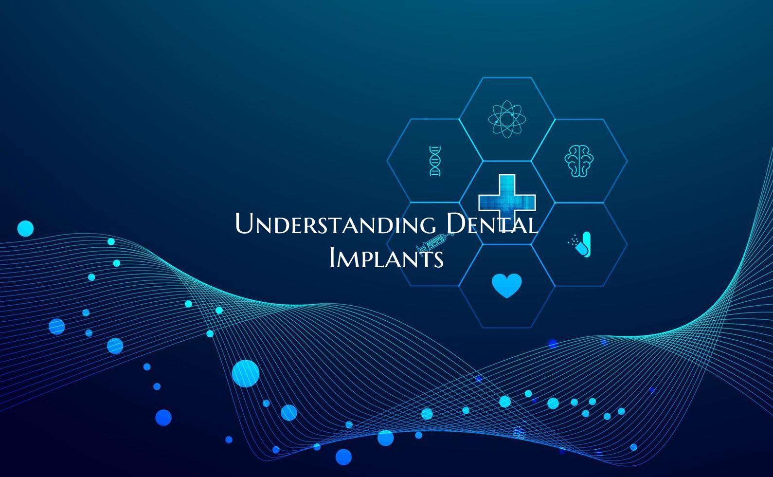Understanding Dental Implants