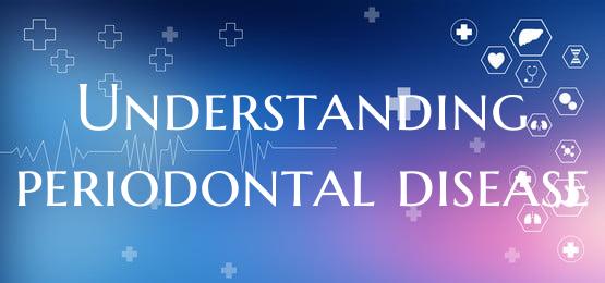 Understanding periodontal disease