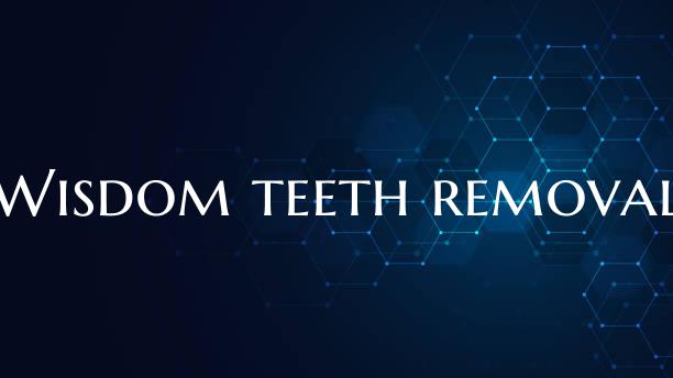 Wisdom teeth removal