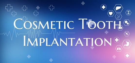 Cosmetic Tooth Implantation