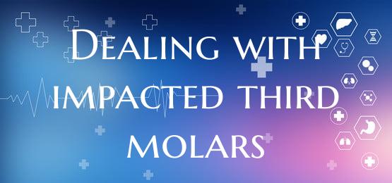 Dealing with impacted third molars