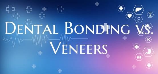 Dental Bonding vs. Veneers
