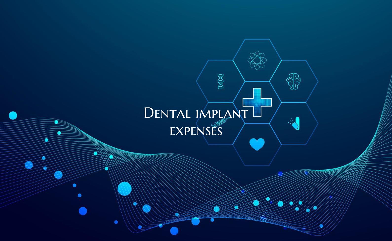 Dental implant expenses