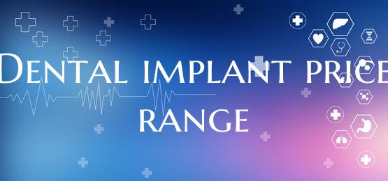 Dental implant price range