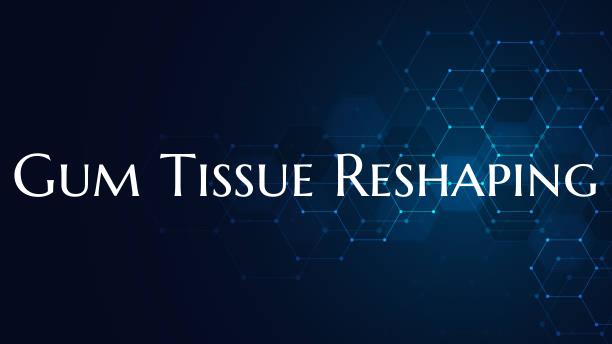 Gum Tissue Reshaping