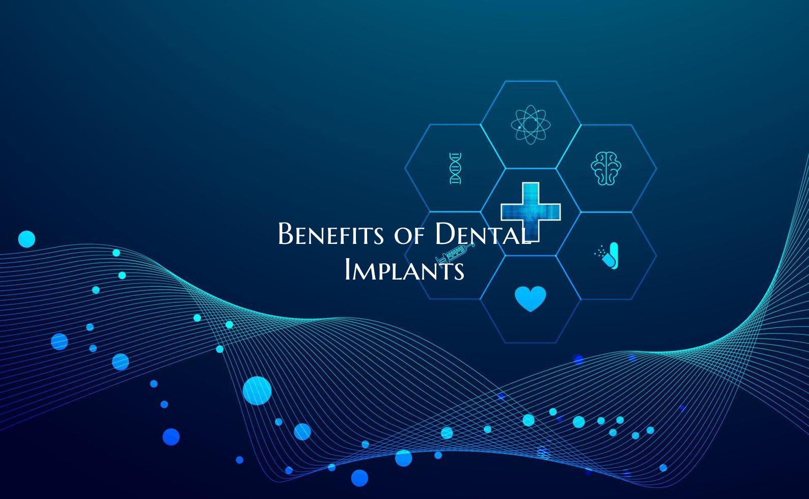 Benefits of Dental Implants