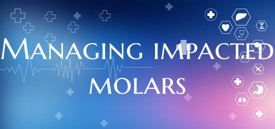 Managing impacted molars