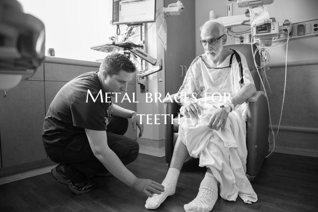 Metal braces for teeth