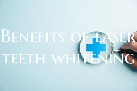 Benefits of laser teeth whitening